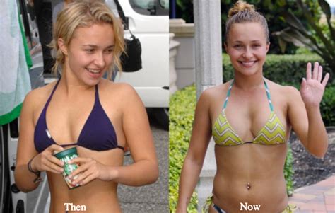 Hayden Panettiere Plastic Surgery Before and After Photos - Latest ...