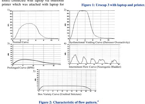 A prospective study of uroflowmetry in 100 patients with lower urinary tract symptoms | Semantic ...