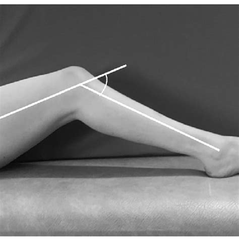 Examination position of knee flexion contracture. By using a goniometer ...