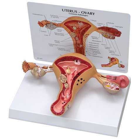 Uterus-Ovary Model - 1019594 - W33352 - 3480 - Genital and Pelvis Models | Anatomical Models