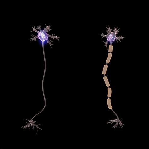 Saltatory Conduction - Lets jump the signal. | Doc Jana