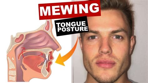 Mewing Tongue Posture Diagram