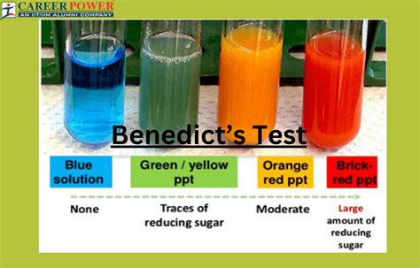 Benedict's Test - Reagent, Composition, Principal and Uses