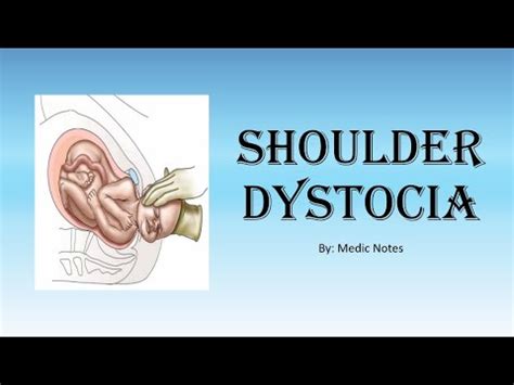 [O&G] Shoulder dystocia - definition, risk factors, sign, management, HELPERRR drill ...