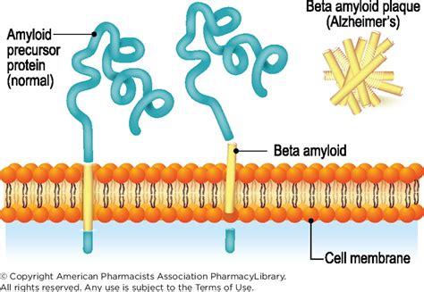 Amyloid-Plaque Formation: Alzheimer’s Disease | PharmacyLibrary