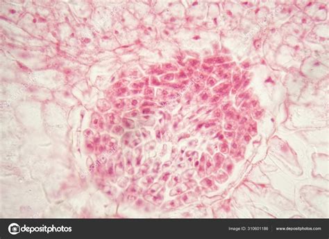 Root bacteria nodules under the microscope. Stock Photo by ©ChWeiss 310601186