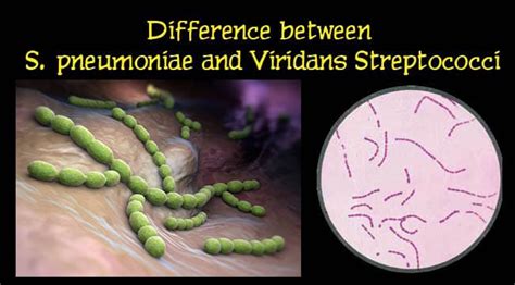 Differences Between Archives - Microbiology Info.com