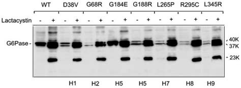 The effect of the proteasome inhibitor lactacystin on degradation of ...