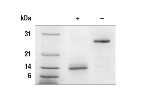 Human GDF15 Recombinant Protein | Cell Signaling Technology