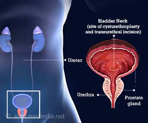 Male Bladder Neck Anatomy