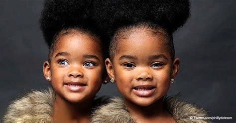 Twin girls who became famous because of their unique eye color are all ...