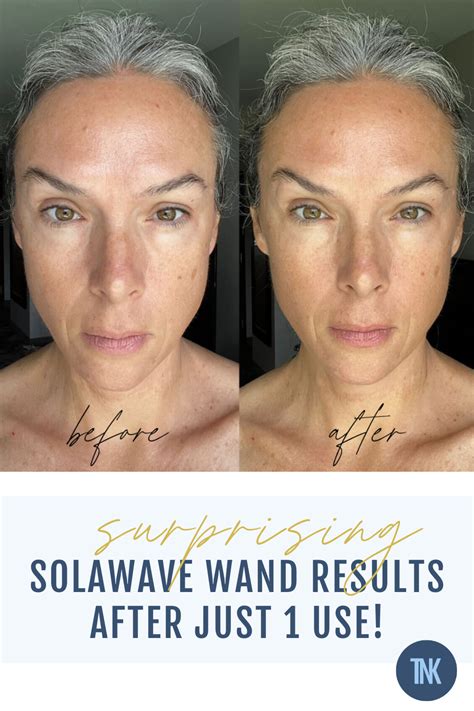 Surprising SolaWave Results After 1 Day (Before + After Photos) - The New Knew