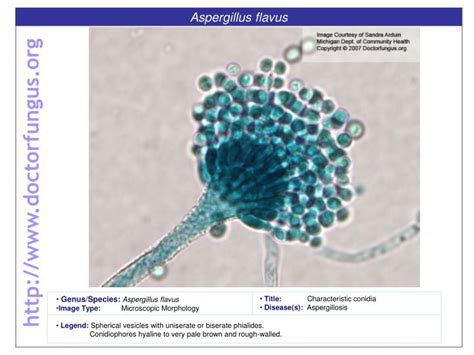 PPT - Aspergillus flavus PowerPoint Presentation, free download - ID:1699676