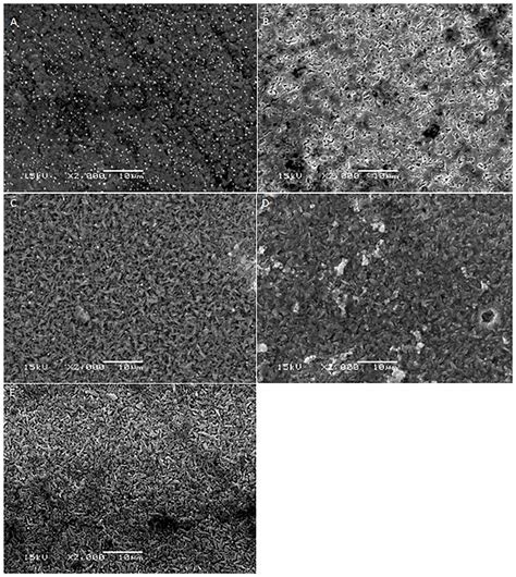 IJMS | Special Issue : Molecular Research on Dental Materials and Biomaterials