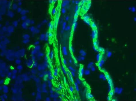 Alpha-Smooth Muscle Actin Antibody (MA1-06110)