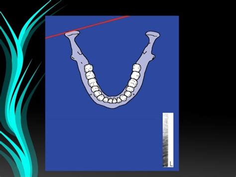 Orthopantomography