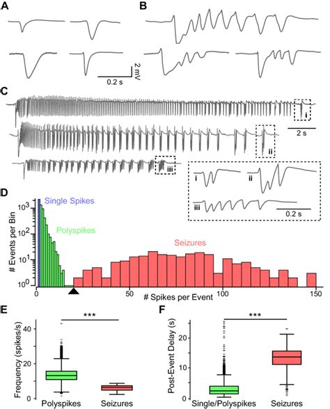 Distribution and characteristics of detected epileptiform events. A-C:... | Download Scientific ...