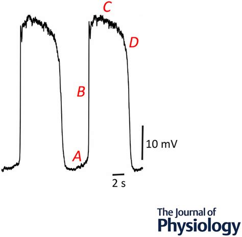 Interstitial cells of Cajal – pacemakers of the gastrointestinal tract ...