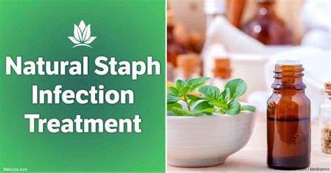 Natural Staph Infection Treatment