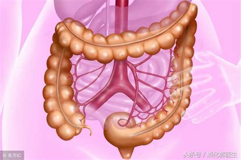 人稱慢性癌症，有終身復發傾向卻只能用藥物控制——潰瘍性結腸炎 - 每日頭條