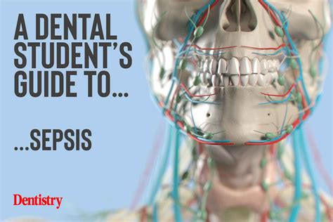 A dental student's guide to...sepsis - Dentistry