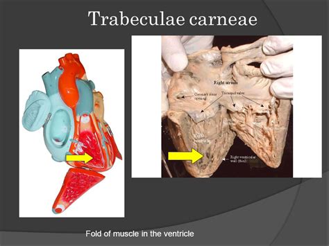 Trabeculae Carneae Histology