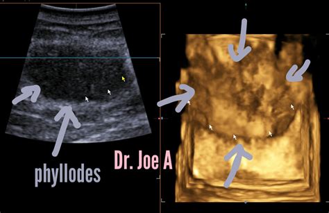 Ultrasound imaging: 2018