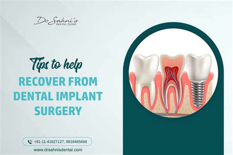 Tips To Help Recover From Dental Implant Surgery | Dr Sahni’s Dental Clinic