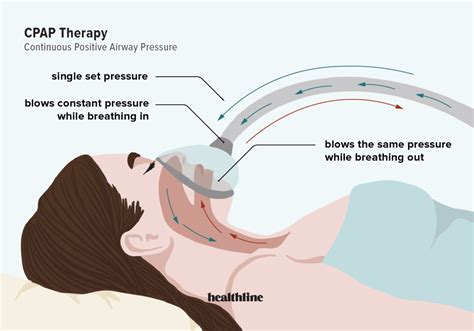 APAP vs. CPAP vs. BiPAP: How Sleep Apnea Therapies Differ