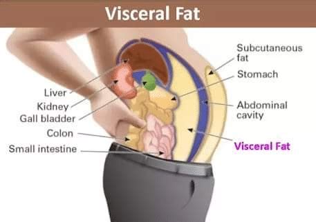 Beware Of The Visceral Fat! - By Dt. Itu Chhabra | Lybrate