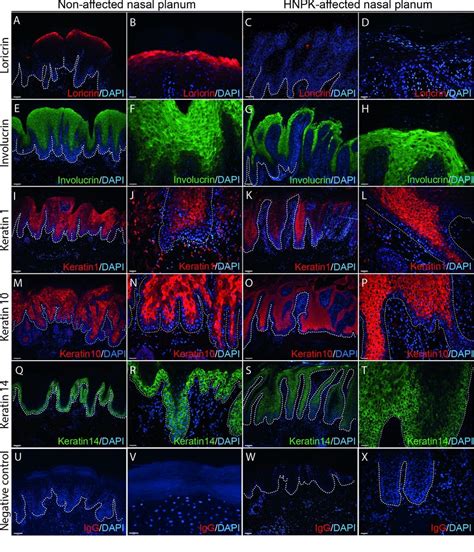 Immunofluorescence microscopy of control and HNPK nasal planum. The... | Download Scientific Diagram