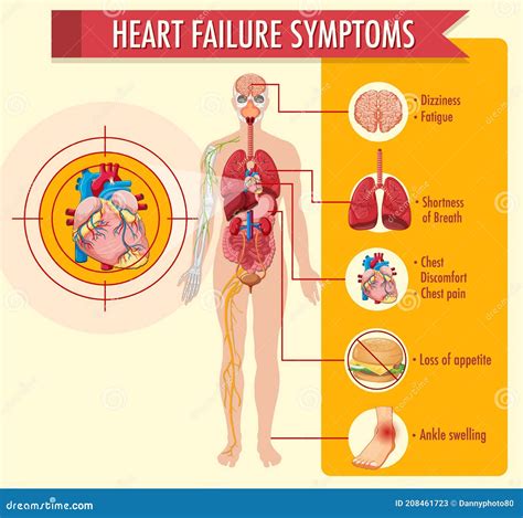 Heart Failure Symptoms Information Infographic Stock Vector ...