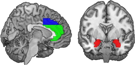 Anterior Cingulate Cortex Function Psychology - cloudshareinfo