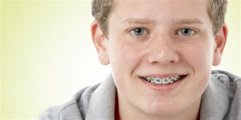 Color Braces in Ft. Collins, CO | Milnor Orthodontics