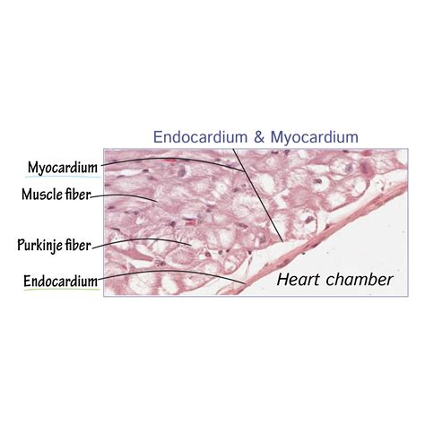 Histology Glossary: Heart Wall Histology | ditki medical & biological ...