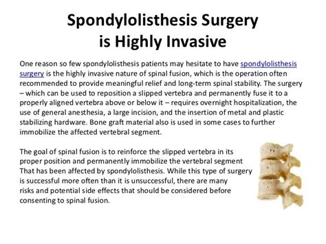 Spondylolisthesis Surgery