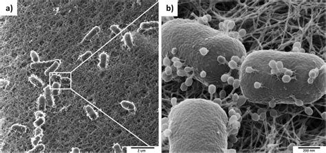 Phage microscopy: The Types, Techniques, and Importance