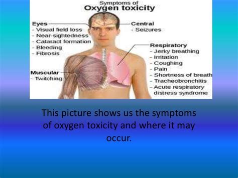 Oxygen toxicity