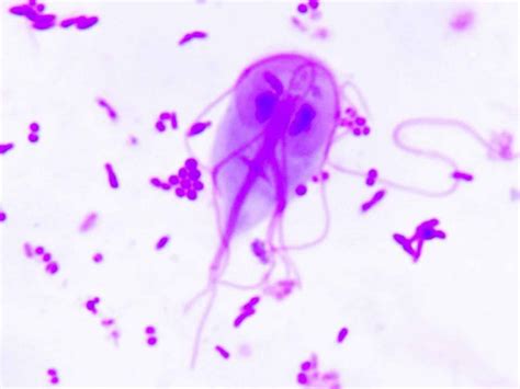 Giardia duodenalis causes, prevention, symptoms, diagnosis & treatment