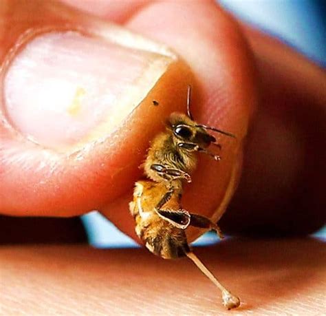 Apitherapie: soigner les douleurs articulaires avec du venin d'abeille