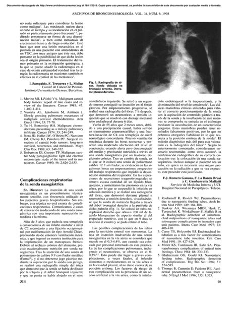 Complicaciones respiratorias de la sonda nasogástrica