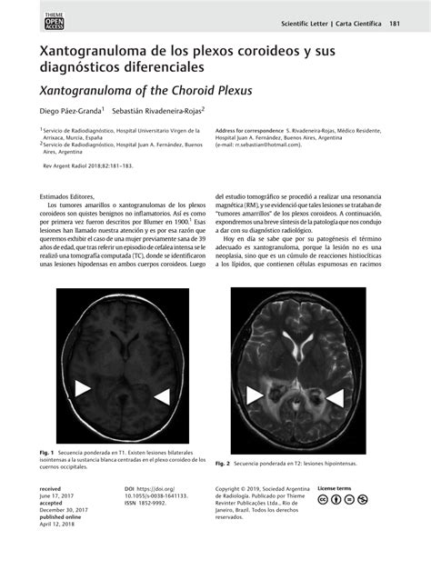 (PDF) Xantogranuloma de los plexos coroideos y sus diagnósticos diferenciales