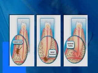 Endo – Perio lesions.ppt