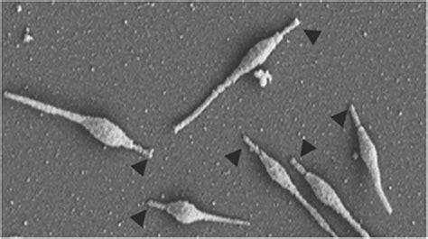 Mycoplasma pneumoniae: Properties, Disease, Diagnosis • Microbe Online