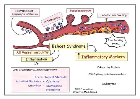 Behcet syndrome: Ulcers, Blindness and Vasculitis - Creative Med Doses