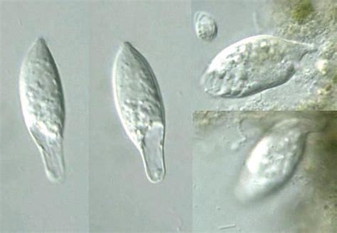 Protist Images: Unidentified Ciliophora