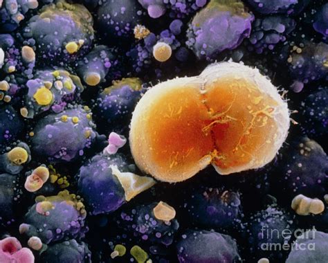 F. Colour Sem Of A Dividing Primordial Germ Cell Photograph by Professors P.m. Motta & S. Makabe ...