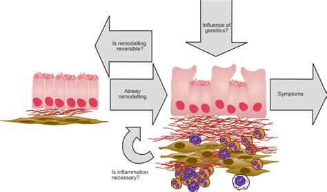 Critical questions in airway remodelling today. | Download Scientific Diagram