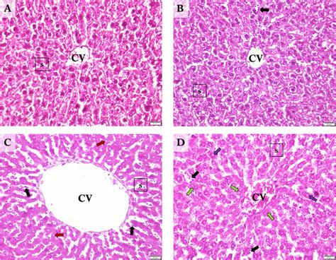 Representative Photomicrographs of the Liver Sections. A, Control;... | Download Scientific Diagram