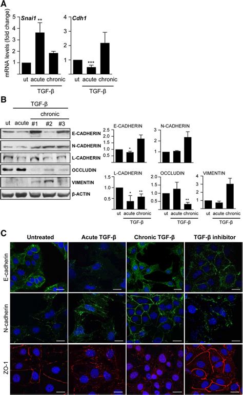 Epithelial and mesenchymal markers in oval cells treated or not with ...